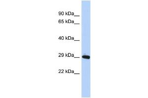 WB Suggested Anti-ZNF524 Antibody Titration:  0.