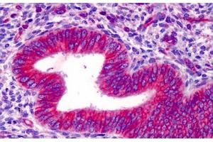 Human Uterus: Formalin-Fixed, Paraffin-Embedded (FFPE) (HMGCS1 antibody  (AA 251-300))