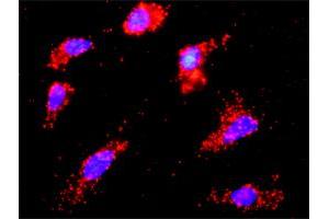 Proximity Ligation Analysis of protein-protein interactions between TP53 and CSNK1E. (CK1 epsilon antibody  (AA 2-100))