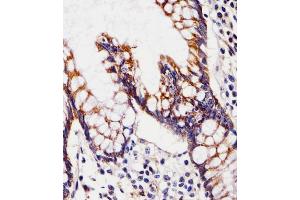 (ABIN6243813 and ABIN6577796) staining CHST12 in Human small intestine tissue sections by Immunohistochemistry (IHC-P - paraformaldehyde-fixed, paraffin-embedded sections). (CHST12 antibody  (N-Term))