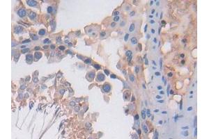 IHC-P analysis of Rat Testis Tissue, with DAB staining. (PF4 antibody  (AA 30-105))