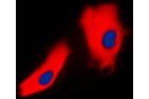 Immunofluorescent analysis of Gamma-catenin staining in A431 cells. (JUP antibody  (C-Term))