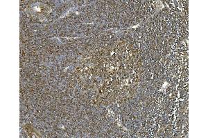 IHC analysis of Hsc70 using anti-Hsc70 antibody (ABIN7601962). (Hsc70 antibody  (AA 520-614))