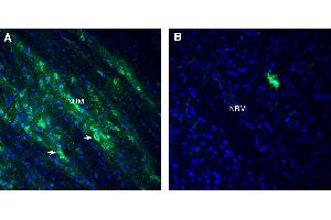 Free-floating frozen brain sections from a paraformaldehyde-perfused mouse were incubated with Anti-GPR151 (extracellular) antibody (ABIN7884968, 1:300), followed by goat anti-rabbit secondary antibody conjugated to Alexa Fluor® 488 (green).