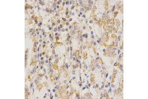Immunohistochemistry (IHC) image for anti-CD151 (CD151) antibody (ABIN1871589) (CD151 antibody)