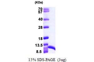 SDS-PAGE (SDS) image for S100 Calcium Binding Protein A6 (S100A6) (AA 1-90) protein (His tag) (ABIN667387) (S100A6 Protein (AA 1-90) (His tag))