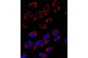 Confocal immunofluorescence analysis of U2OS cells using MRPS31 Polyclonal Antibody (ABIN6133059, ABIN6144045, ABIN6144046 and ABIN6216735) at dilution of 1:200. (MRPS31 antibody  (AA 66-395))