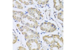 Immunohistochemistry of paraffin-embedded human stomach using RCN2 antibody (ABIN5975169) at dilution of 1/100 (40x lens).