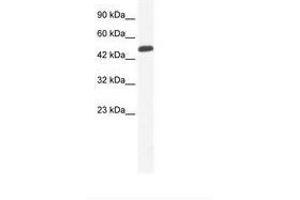 Image no. 1 for anti-Zinc Finger Protein 239 (ZNF239) (AA 41-90) antibody (ABIN6735993)