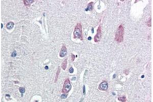 Human Brain, Cortex (formalin-fixed, paraffin-embedded) stained with VPS25 antibody ABIN337136 at 5 ug/ml followed by biotinylated goat anti-rabbit IgG secondary antibody ABIN481713, alkaline phosphatase-streptavidin and chromogen. (VPS25 antibody  (N-Term))