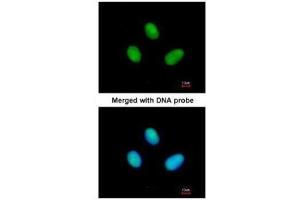ICC/IF Image Immunofluorescence analysis of paraformaldehyde-fixed HeLa, using RPB2, antibody at 1:200 dilution. (POLR2B antibody  (N-Term))