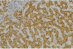 ABIN6276546 at 1/100 staining Mouse liver tissue by IHC-P. (SH2D1A antibody  (Internal Region))