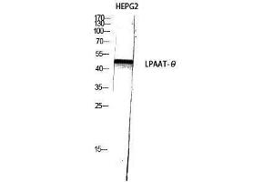 AGPAT9 antibody  (C-Term)