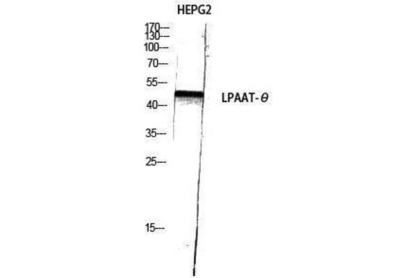 AGPAT9 antibody  (C-Term)
