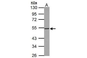 WB Image PD-ECGF antibody detects TYMP protein by Western blot analysis. (Thymidine Phosphorylase antibody)