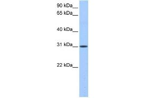 HUS1B antibody used at 0. (HUS1B antibody)