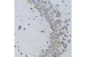 Immunohistochemistry of paraffin-embedded rat brain using PTPN1 antibody (ABIN1980139) at dilution of 1:100 (40x lens). (PTPN1 antibody)