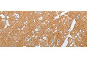 Immunohistochemistry of paraffin-embedded Human brain tissue using SLC17A7 Polyclonal Antibody at dilution of 1:200(x200) (SLC17A7 antibody)