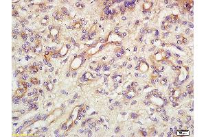 Formalin-fixed and paraffin embedded mouse tumor tissue labeled with Anti Endomucin Polyclonal Antibody, Unconjugated (ABIN1385912) at 1:200 followed by conjugation to the secondary antibody and DAB staining