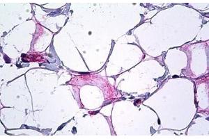 Human Breast, Collagen: Formalin-Fixed, Paraffin-Embedded (FFPE) (COL18A1 antibody  (AA 801-850))