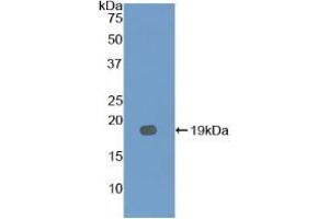 Western blot analysis of recombinant Mouse IL12Rb2.