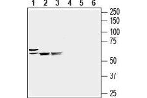 Western blot analysis of mouse heart (lanes 1 and 4), mouse brain (lanes 2 and 5) and rat brain (lanes 3 and 6) lysates: - 1-3. (SLC6A8 antibody  (C-Term, Extracellular))