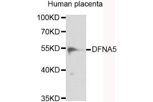 Western blot analysis of extracts of human placenta, using DFNA5 antibody. (DFNA5 antibody)
