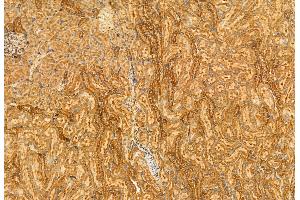 ABIN6261603 and ABIN6272958 at 1/100 staining Rat kidney tissue by IHC-P.
