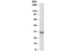 Western blot testing of human skeletal muscle lysate with FHL3 antibody at 1ug/ml. (FHL3 antibody)