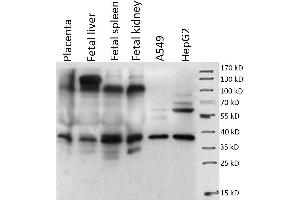 Western Blotting (WB) image for anti-Placenta-Specific 1 (PLAC1) antibody (ABIN1855659) (PLAC1 antibody)