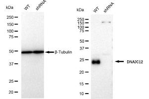 anti-DnaJ (Hsp40) Homolog, Subfamily C, Member 12 (DNAJC12) antibody
