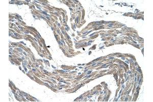 GPR161 antibody was used for immunohistochemistry at a concentration of 4-8 ug/ml to stain Skeletal muscle cells (arrows) in Human Muscle.