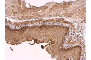 IHC-P Image KIDINS220 antibody [C3], C-term detects KIDINS220 protein at membrane on mouse esophagus by immunohistochemical analysis. (KIDINS220 antibody  (C-Term))