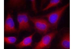 Immunofluorescence staining of methanol-fixed Hela cells using VASP(Ab-157) Antibody. (VASP antibody)