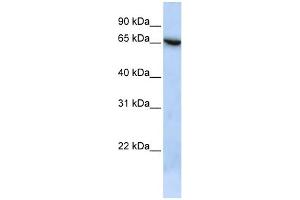 WB Suggested Anti-C19orf6 Antibody Titration: 0. (Membralin antibody  (N-Term))