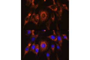 Immunofluorescence analysis of NIH/3T3 cells using UB Rabbit pAb (ABIN7271120) at dilution of 1:100. (UBAC2 antibody  (AA 220-310))