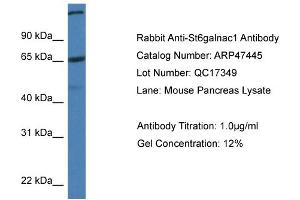 Western Blotting (WB) image for anti-ST6 (Alpha-N-Acetyl-Neuraminyl-2,3-beta-Galactosyl-1,3)-N-Acetylgalactosaminide alpha-2,6-Sialyltransferase 1 (ST6GALNAC1) (C-Term) antibody (ABIN2782969) (ST6GALNAC1 antibody  (C-Term))