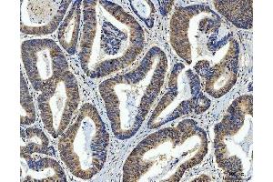 IHC analysis of AREB6/ZEB1 using anti-AREB6/ZEB1 antibody (ABIN7602990).