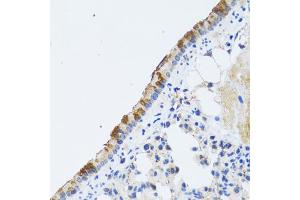 Immunohistochemistry of paraffin-embedded rat lung using ST3GAL3 antibody (ABIN2560155) at dilution of 1:100 (40x lens). (ST3GAL3 antibody)