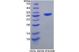 SDS-PAGE analysis of Mouse TRAF1 Protein. (TRAF1 Protein)