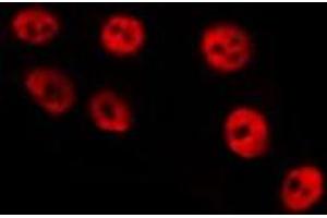 ABIN6275313 staining HepG2 by IF/ICC. (PPP1R8 antibody  (Internal Region))