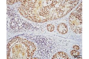 Immunohistochemistry analysis using Rat Anti-HSF1 Monoclonal Antibody, Clone 10H8 (ABIN361703 and ABIN361704).