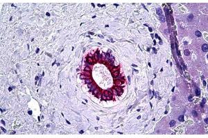Human Liver, Bile Duct: Formalin-Fixed, Paraffin-Embedded (FFPE) (KRT8 antibody)
