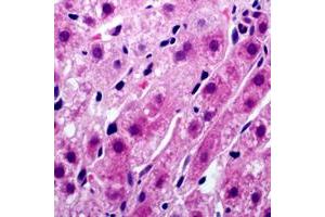 Immunohistochemistry (IHC) image for anti-Tyrosinase (TYR) (C-Term) antibody (ABIN7297216)