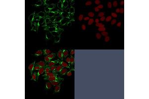 Confocal Immunofluorescence image of HeLa cells stained with Clathrin, HC Monoclonal Antibody (CHC/1432) followed by Goat anti-Mouse CF488 (green). (Clathrin Heavy Chain (CLTC) antibody)