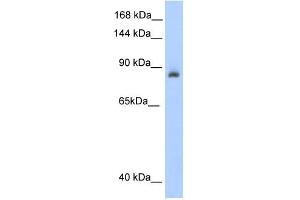 ACO1 antibody used at 0. (Aconitase 1 antibody  (N-Term))