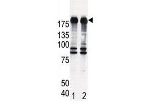 Western blot analysis of EGF Receptor antibody and HeLa cell lysate, either induced (Lane 1) or noninduced with EGF (2). (EGFR antibody  (AA 1048-1077))