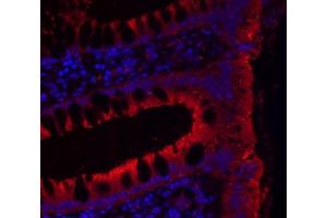 IHC-P Image Immunohistochemical analysis of paraffin-embedded human colon, using JAM-B, antibody at 1:200 dilution.