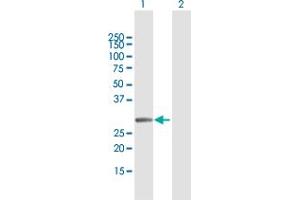 Western Blot analysis of MMS19 expression in transfected 293T cell line by MMS19 MaxPab polyclonal antibody.