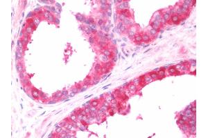 Anti-COL4A3BP / CERT antibody IHC staining of human prostate. (COL4A3BP antibody  (N-Term))